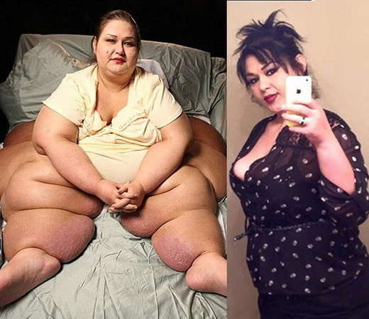 La mujer más gorda del mundo ya bajó 400 kilos | Nuestra Córdoba